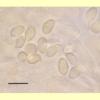 images/Armillaria/Armillaria_novae-zelandiae_(spores_Melzers)_AE_18.jpg