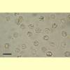 images/Entoloma_(other)/CD477_spores_padded.jpg