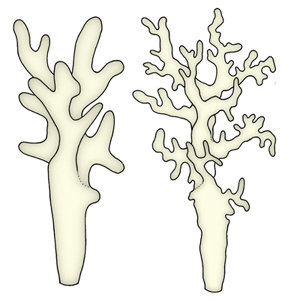 images/Pileocystidia_branching_diverticulate/Cystidia_branching-diverticulate.jpg