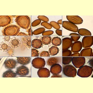 images/Spore_colour_(microscope)_brown/spore_colour_micro_Brown.JPG