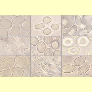 images/Spore_colour_(microscope)_hyaline/spore_colour_micro_Hyaline.jpg