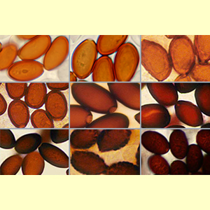 images/Spore_colour_(microscope)_orange-_to_red-brown/spore_colour_micro_Orange_to_Red-Brown.jpg