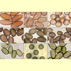 images/Spore_colour_(microscope)_pink_purple_grey_or_green/spore_colour_micro_Greyish_Sepia.jpg