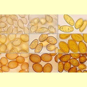 images/Spore_colour_(microscope)_yellow-brown/spore_colour_micro_Yellow_Brown.jpg